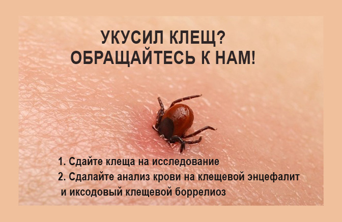 ЧТО ДЕЛАТЬ, ЕСЛИ УКУСИЛ КЛЕЩ?