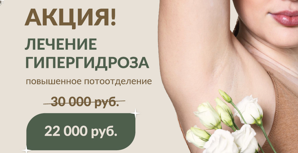 Акция по лечению гипергидроза
